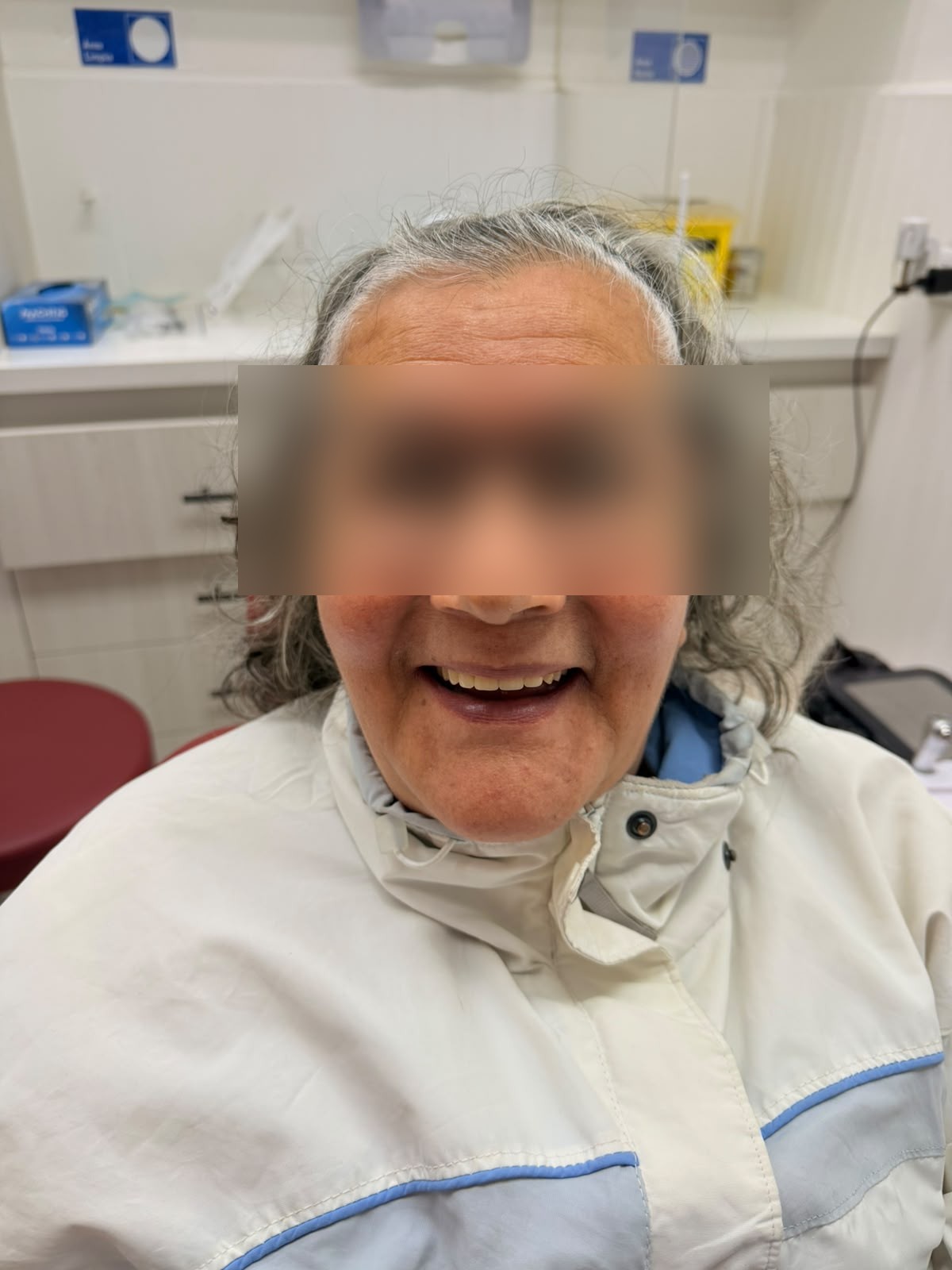 El mismo caso después del tratamiento con la Dra. Javiera Comesaña, con la sonrisa restaurada